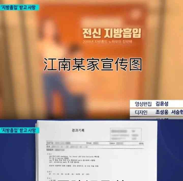  "整容后不幸病逝！韩国整形医院频繁抽脂亡命徒引质疑"